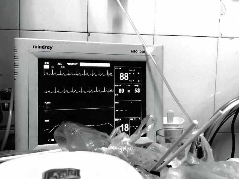 心脏停搏这事儿可太危险了，症状也很明显。首先就是意识突然丧失，人一下子就没反应了