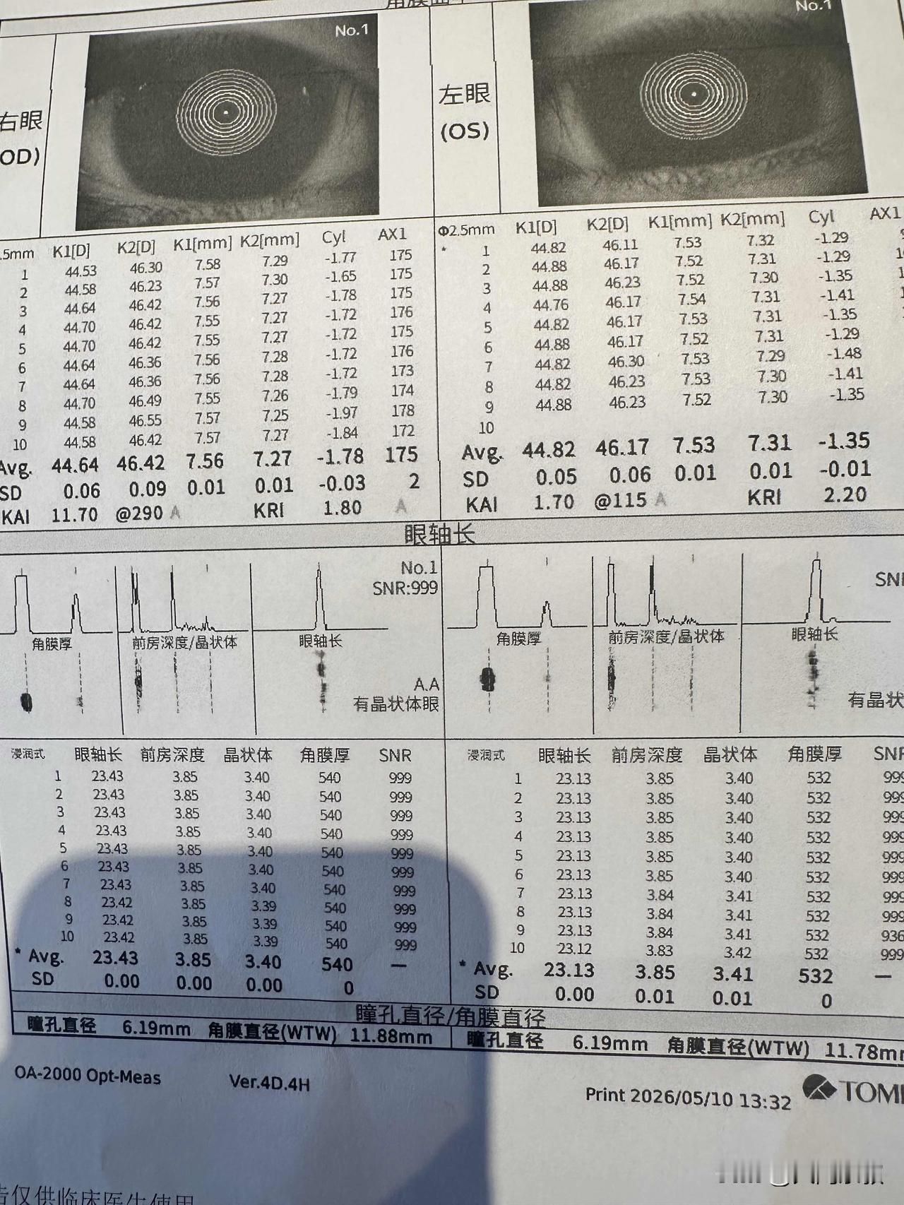 今天带孩子复查眼睛出来我俩在大街上高兴的蹦了起来上次复查是今年的1月18日