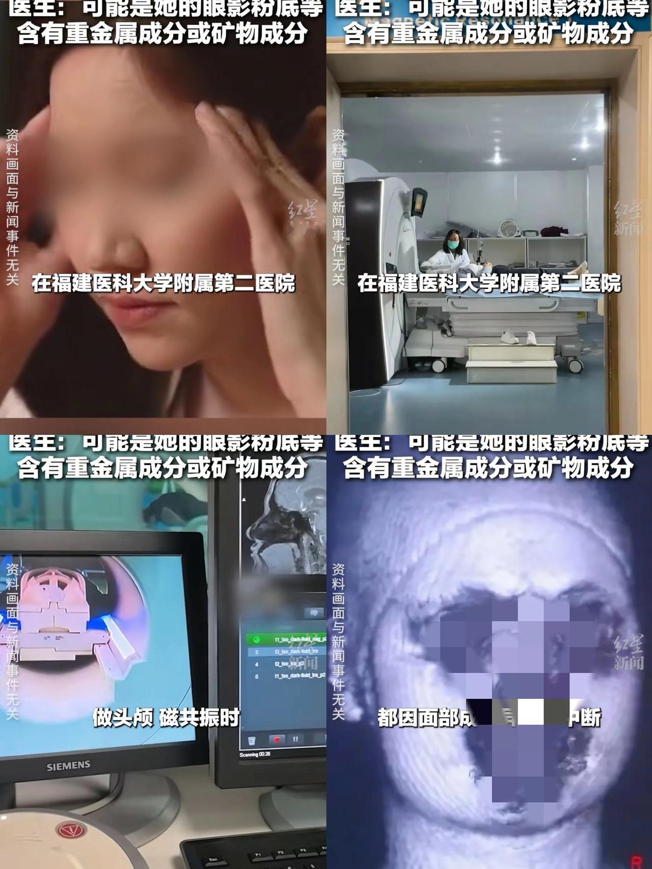 我的老天奶，泉州女子因头晕上医院检查不仅核磁共振两次黑屏，照出的图像更是
