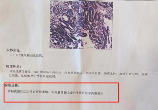 大家好，我是从事肝胆脾胃临床四十余年的中医宋金玲在脾胃调理的众多中药材当中，