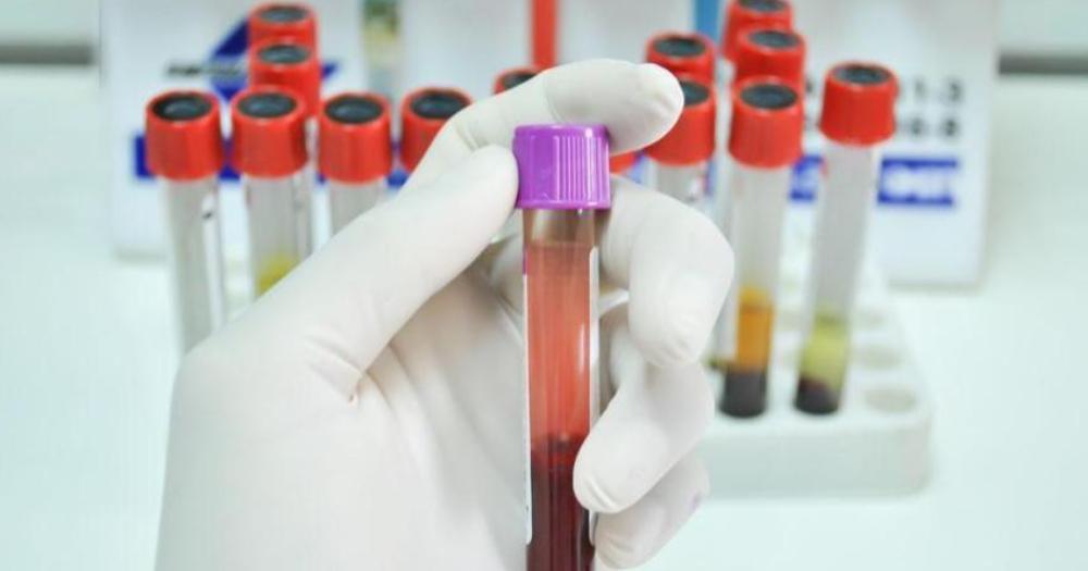 48岁男子饭后昏倒，3天后去世，医生怒斥：这3种食物不要一直吃！饭后突然