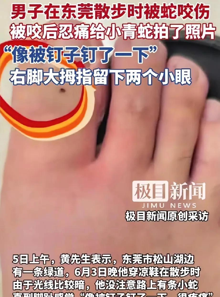 男子在松山湖散步被蛇咬后的操作堪称“教科书”，他第一时间不是打120求救，也不