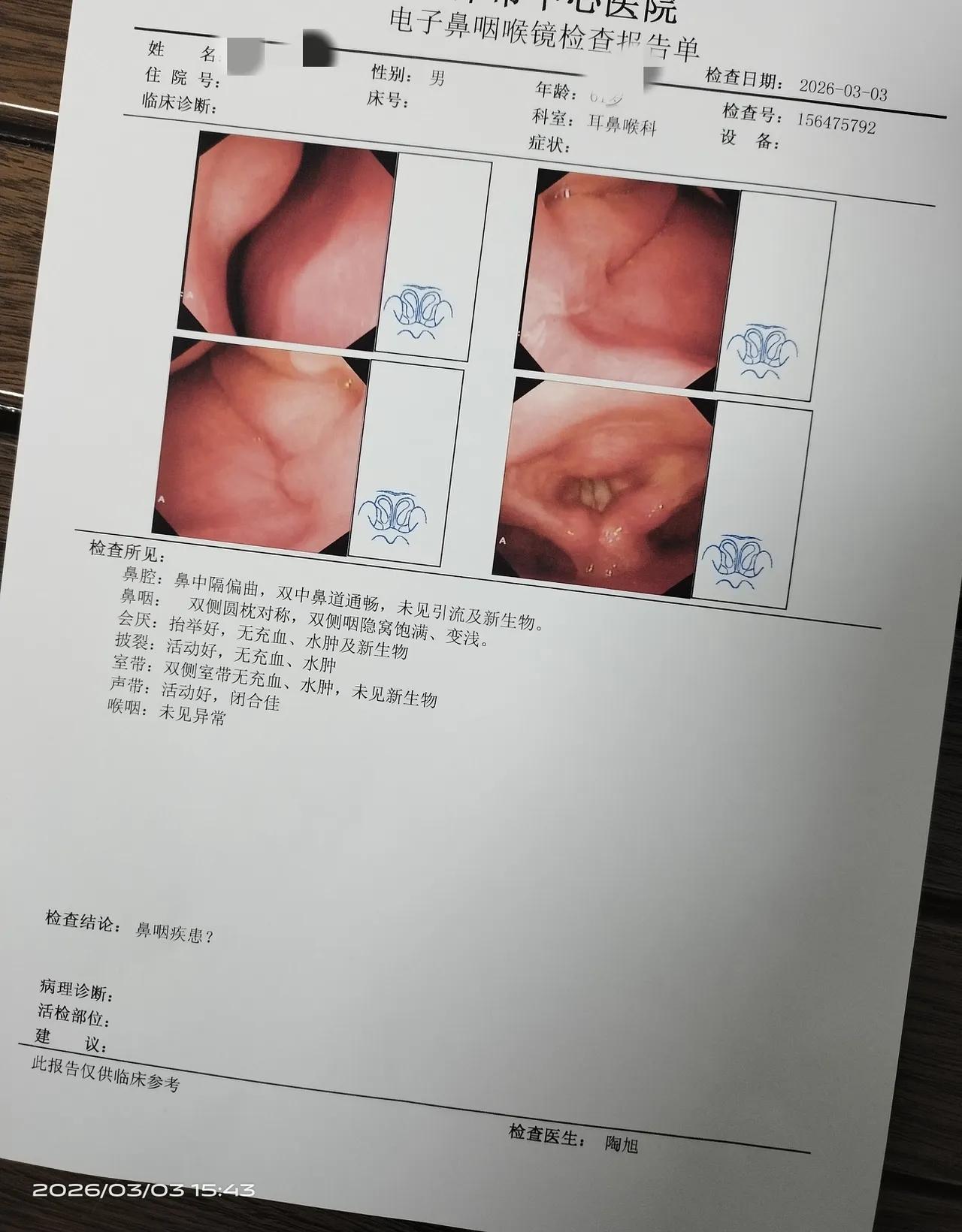 你有时要相信年轻一点的医生！为什么呢？我CT诊断为鼻窦炎，鼻塞流涕严重，去年12