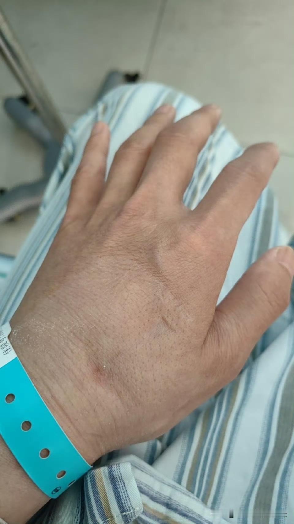 肿瘤医院的床位，好像突然变紧了。不是病人多了，和医院小了。而是现在打化疗装