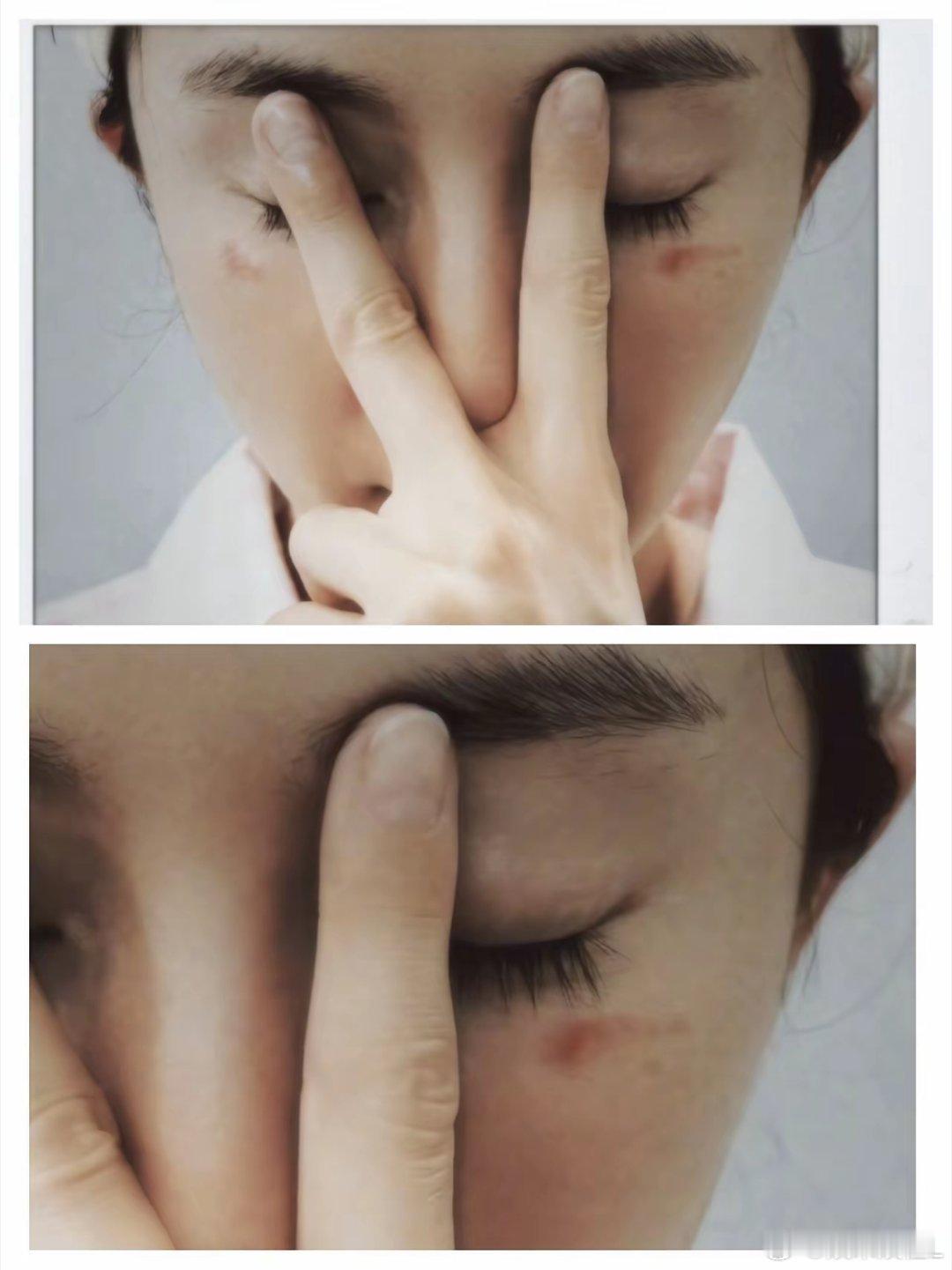 杨幂赵丽颖同日接连冲上热搜，不约而同晒出脸部受伤的动态。同天上热搜，两人状态与画