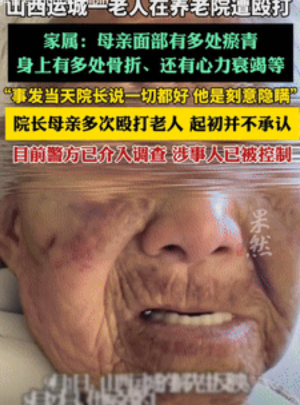 山西运城，一八旬老人因老年痴呆，被家人送到养老院生活，不料，在院期间竟遭到院长母