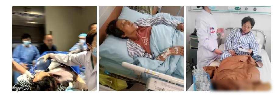 广东一男子在医生宣布母亲停止呼吸后半个小时，流泪恳求医生继续抢救。广东一家