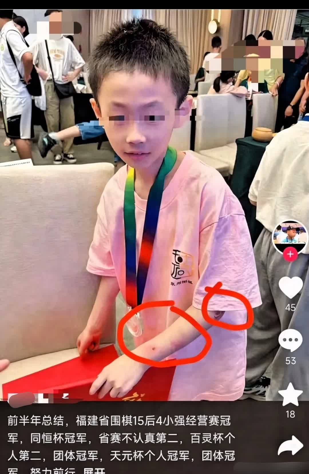 痛心，天才少年一跃而下！围棋天才朱宏鑫，19号晚上从楼上跳下，为