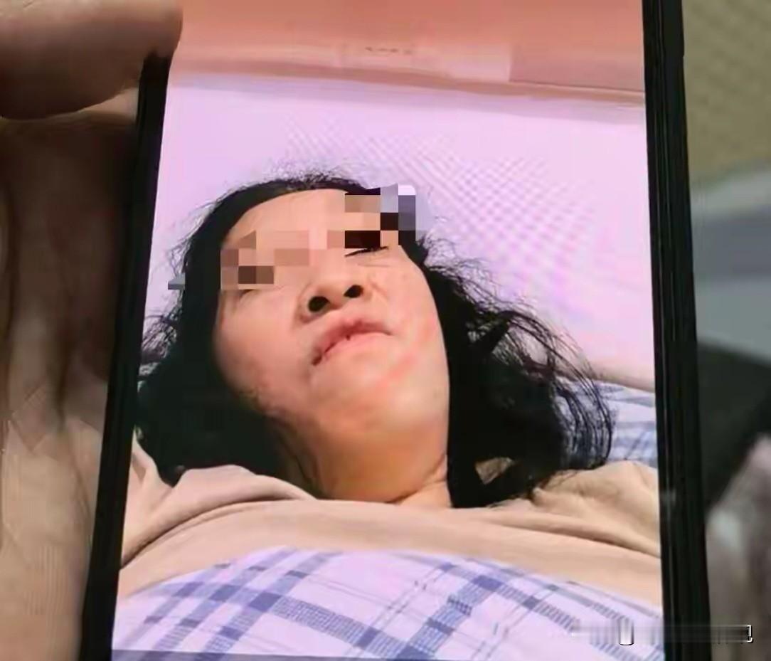 湖南株洲，女子晚上10点在小区遛狗，突然被一只黑背牧羊犬扑倒撕咬，左手被咬断两根