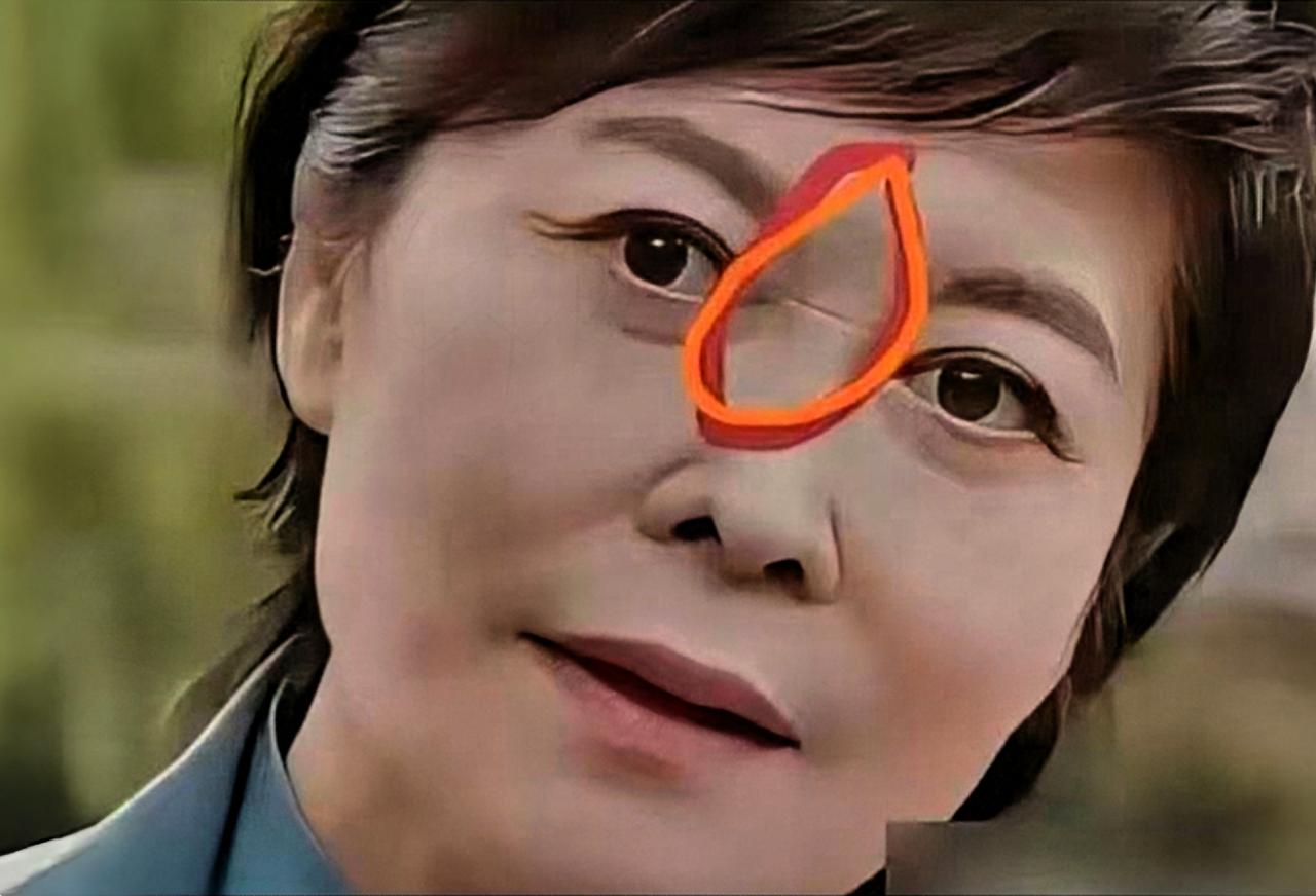 敬一丹鼻梁一道纹被传心脏病！这届网友的养生焦虑，该歇歇了一张照片传到网上