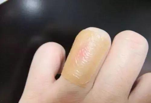 【冬季养生健康生活】晚上睡觉爱抱着暖宝宝, 千万别! 小心......