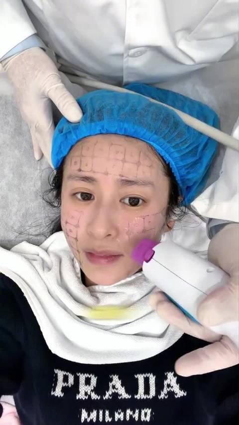 颖儿进组前做热玛吉3月25日，颖儿分享自己的变美vlog，她称自己快进组了，为