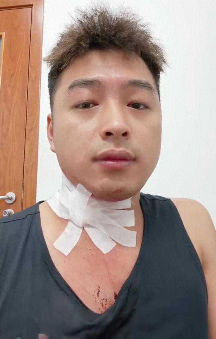 全网首个被蚊子“单杀”的人！脖子被咬一口血流不止，急诊医生直呼少见。最近一条短视