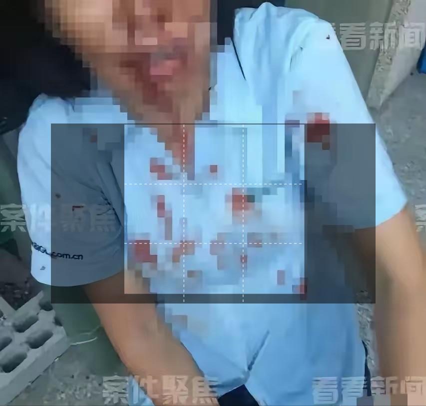 上海，一外甥带5人上门，对舅舅进行围殴，舅妈激愤之下，拿起一瓶强腐蚀性液体，直接