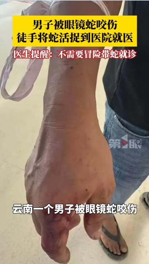 “真是个狠人！”6月21日报道，云南，一男子在家中休息，结果突然一条眼镜蛇闯了进