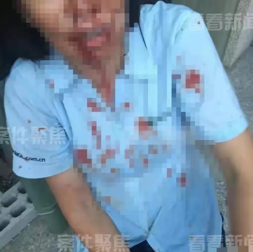 上海，一外甥带5人上门，对舅舅进行围殴，舅妈激愤之下，拿起一瓶强腐蚀性液体，直接