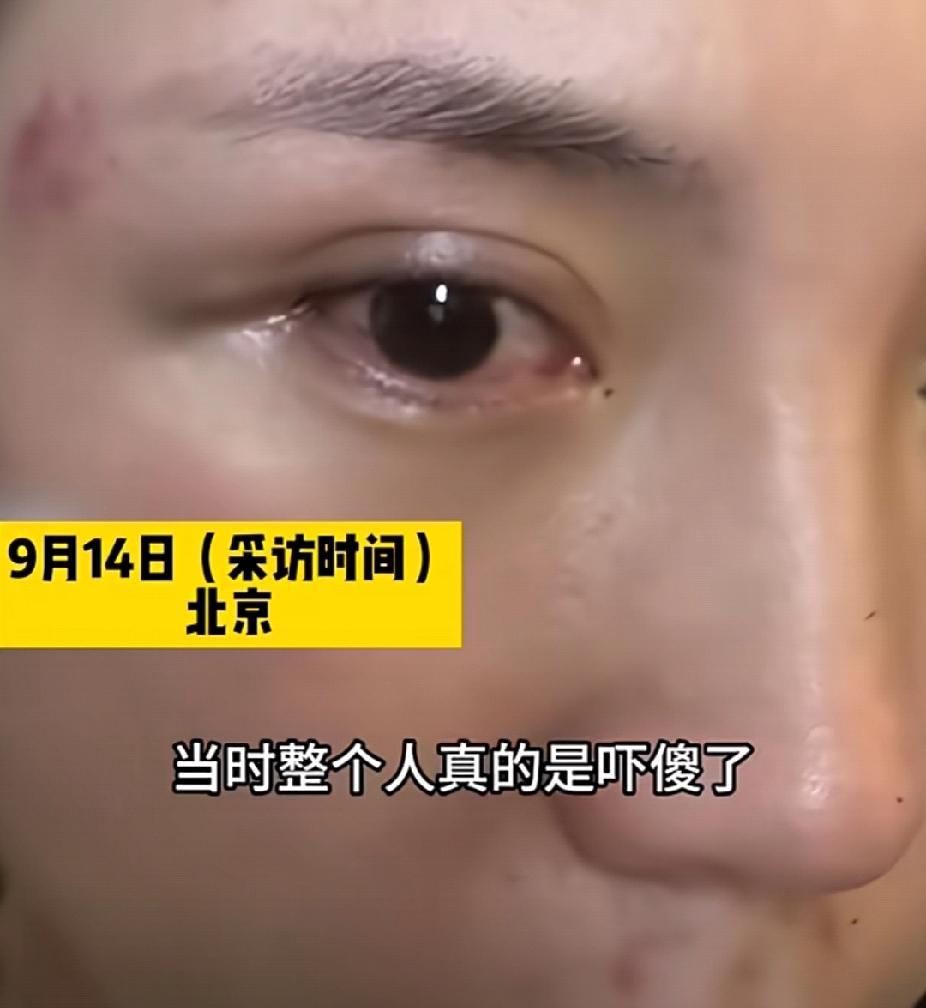 9月13日，北京一女子下班遇鸡蛋大冰雹无处躲避，被砸浑身是伤无助哭泣，两位大哥一