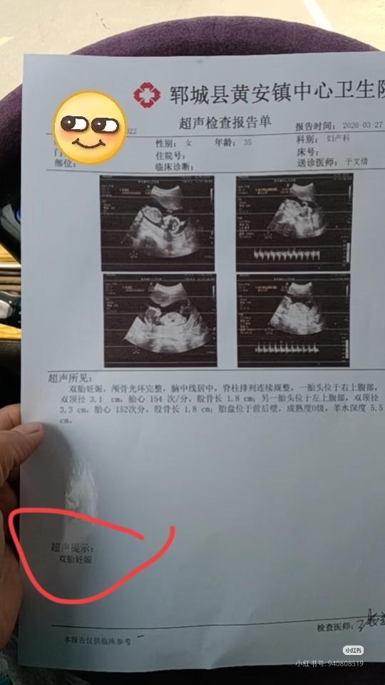 一位做B超的医师说:今年做b超的孕妈好奇怪呀，做b超的孕妈很多都是双胞胎呀！