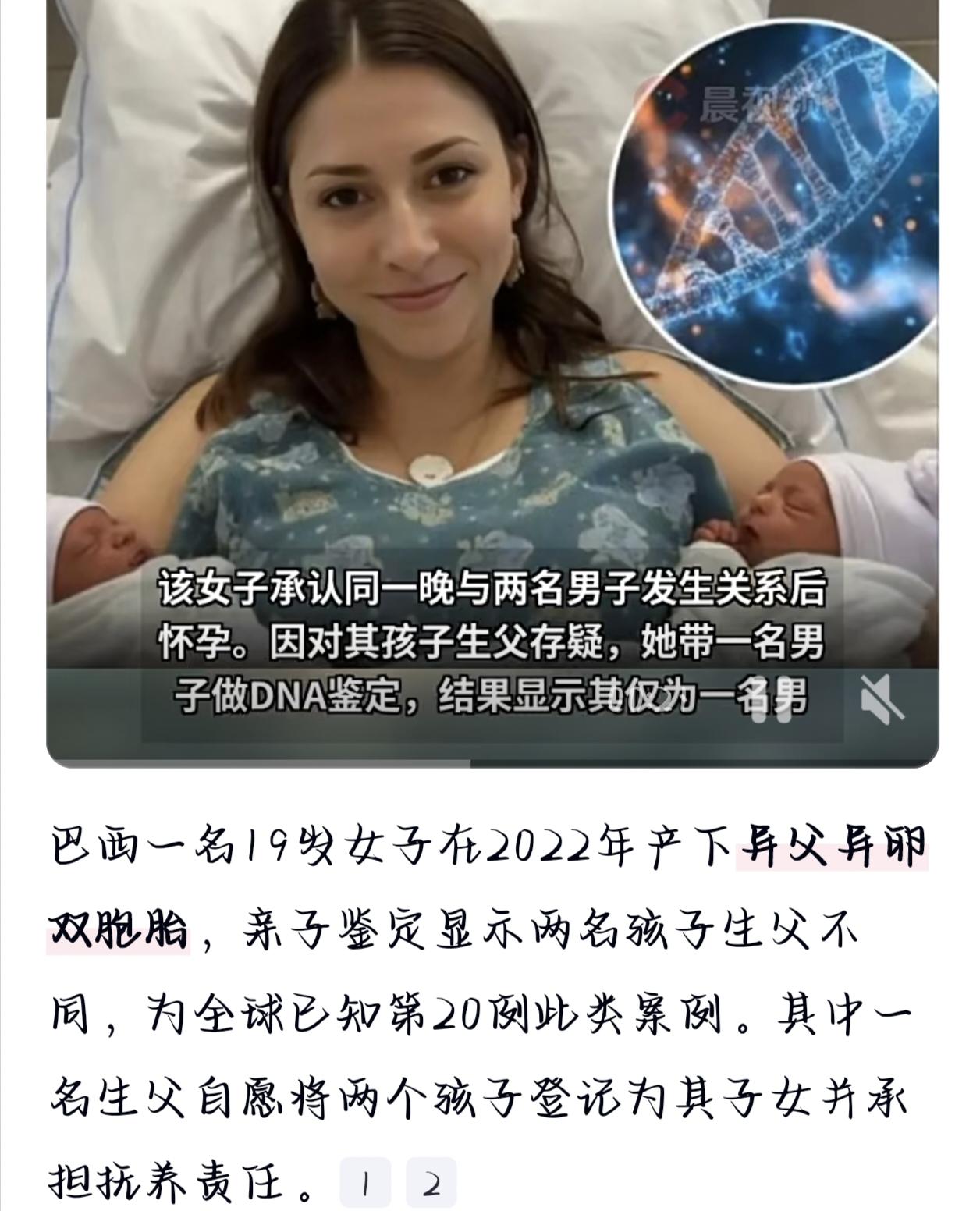 真是活久见！巴西一女子居然生下全球第20例“异父异卵双胞胎”，两个娃同母不同爹，