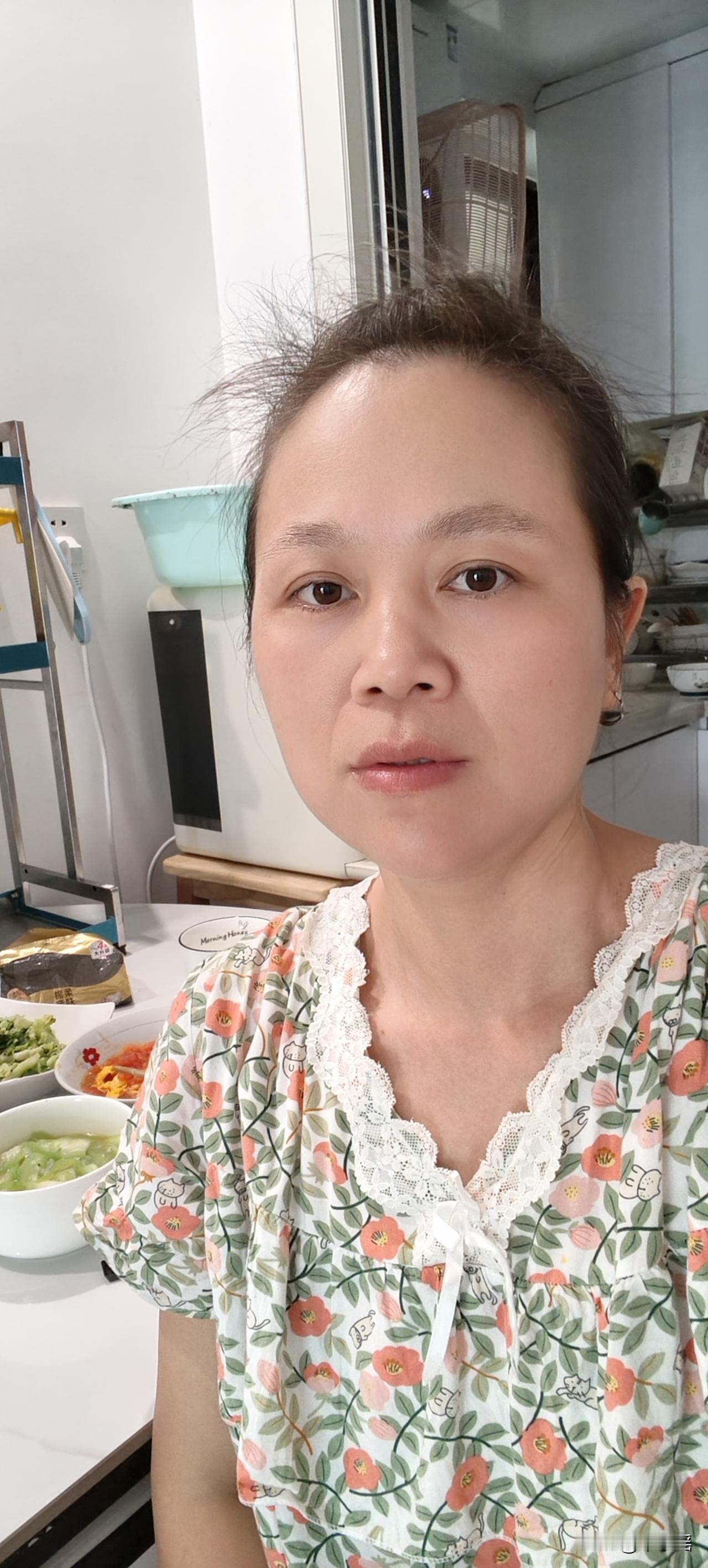 我今年41岁，38岁得了宫颈癌，做了子宫和卵巢双切除，因为术后病理脉管有癌栓等