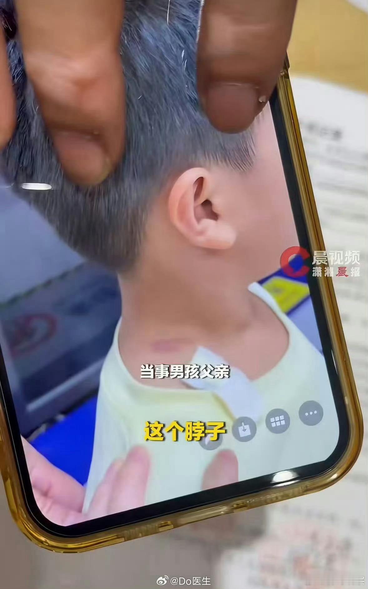 “她用“故意”定了孩子的性，却用“非故意”豁免了自己的行为。”——这才是这件事情无法调和的根本！什么
