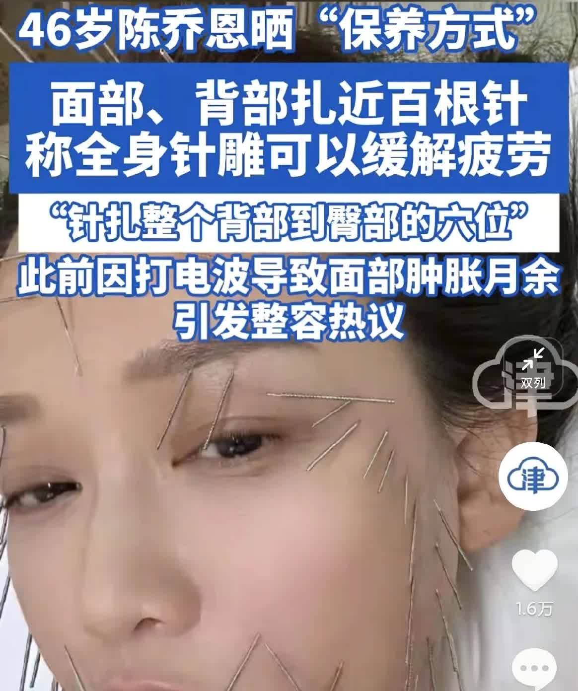 现在女明星终于说实话了，不是靠敷面膜维持美貌了，而是千针万孔。46岁的陈
