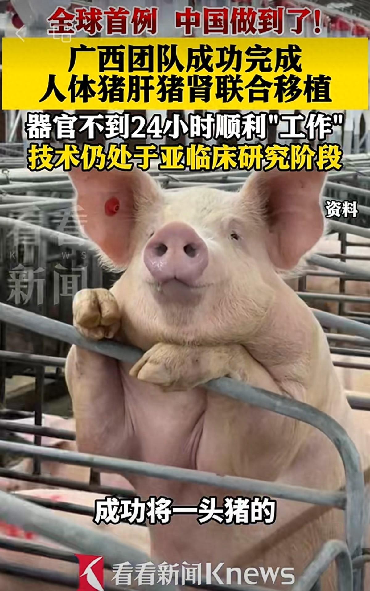 全球首例！广西一帮医生，居然把一整头猪的肝脏，连同两颗猪腰子，一次性移植到了一个