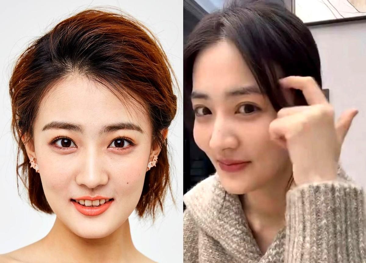 就因为网友一句“牙黄”，演员徐璐花了普通人一年的工资，给上排12颗牙全贴了瓷片。