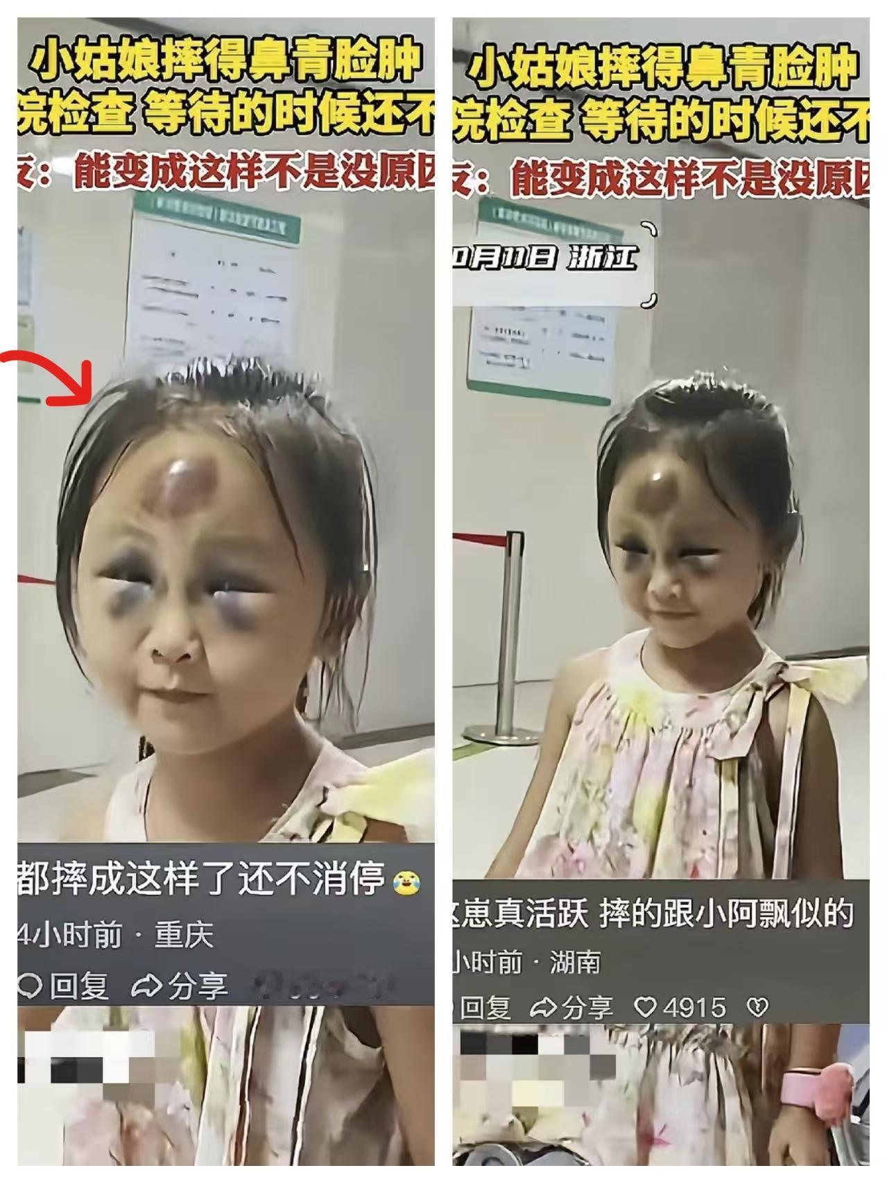 这小姑娘真的是“痛并快乐着”的典型代表！换做一般孩子摔成这样，早就哭唧唧黏人了，