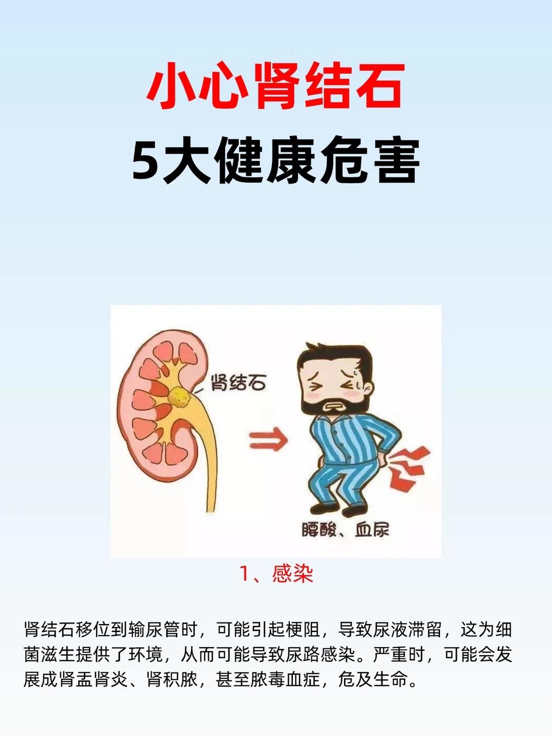 肾结石危害不容小觑，全套治疗方法一次性讲清