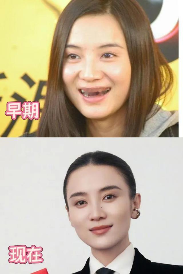 从青涩到沉淀！宋佳面相蜕变引热议，塑造张桂梅后，脸上倔强与慈悲交织，尽显独特气质