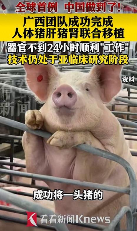 全球首例！广西一帮医生，居然把一整头猪的肝脏，连同两颗猪腰子，一次性移植到了一个