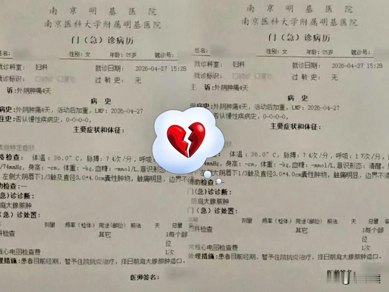 奉劝大家一句生病了，一定多找几家医院看看，未婚女孩隐私部位长囊肿，病号服都穿