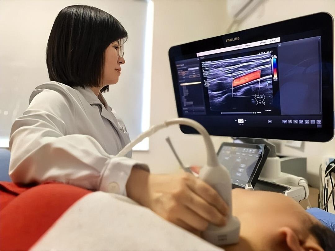 我国有上千万人做颈动脉超声！院士：做一次颈动脉超声，或管6年最近，颈动脉超声