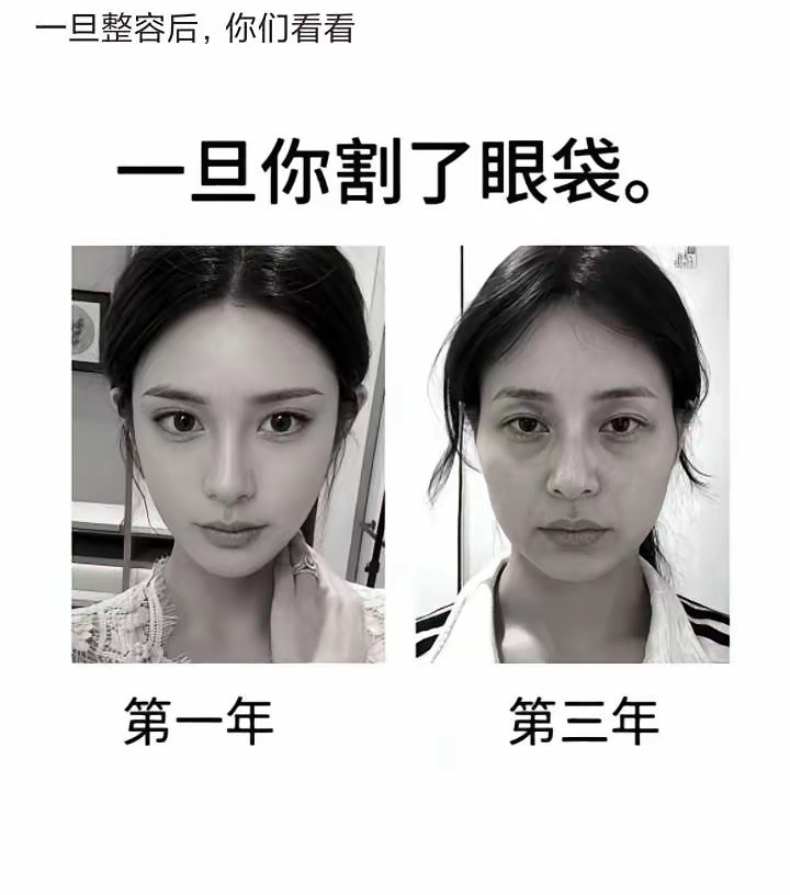 一旦整容后你们看看劝告每位想整容打针的女孩子