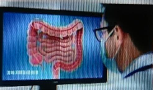 肠镜检查太有必要了！王阿姨单位体检让做肠镜，她嫌从肛门插管子可怕，拖了三年，便血