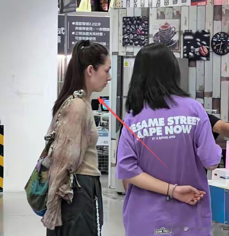 郭碧婷婚后面相都变了，嘴角下垂苦相和出道时仙气飘飘的空灵女孩判若两人。郭碧婷