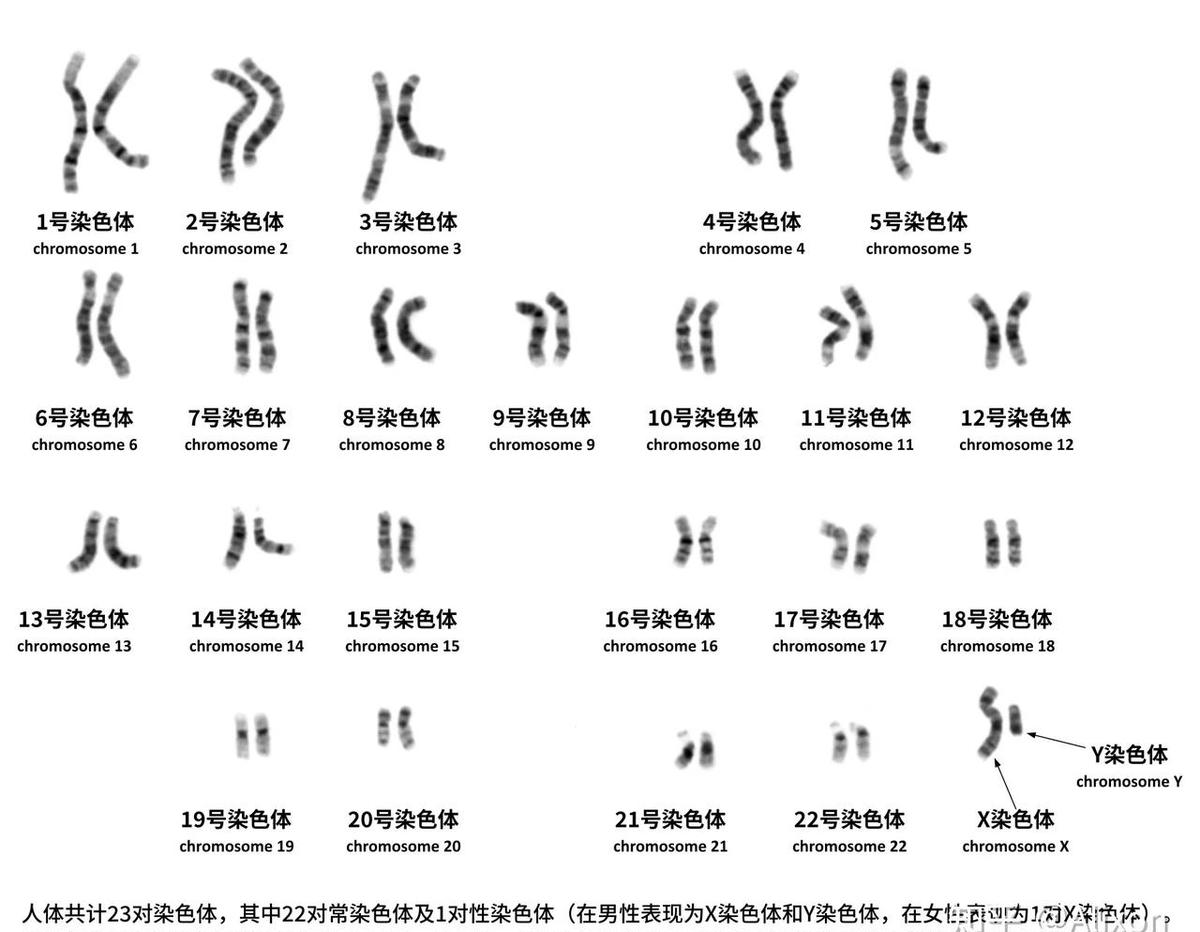1999年，人类第一次把一条染色体彻底看透——不是哪条大块头，是第22号，最小的