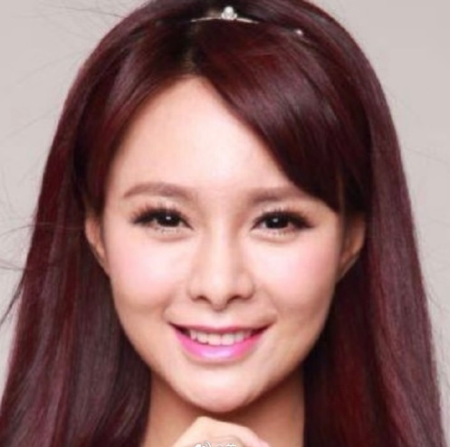 沈梦辰连续4年做热玛吉脸越打越薄之前就说过她一直在做减法才变化那么大的但是骨