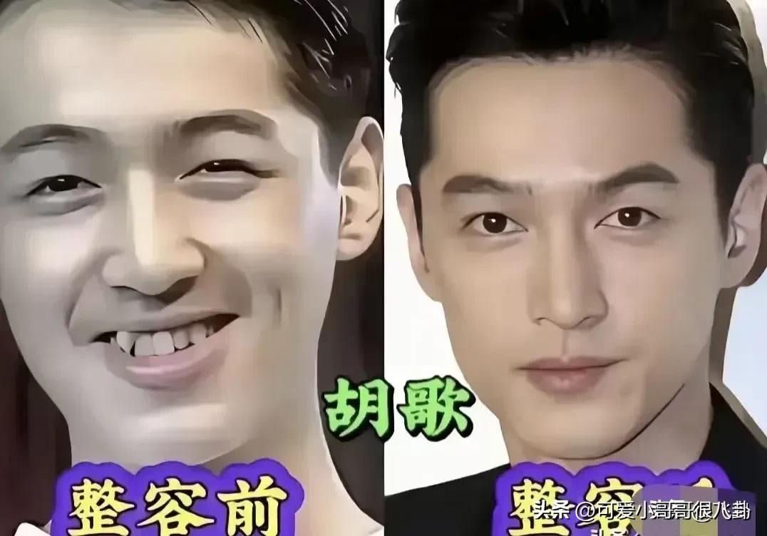 整容后的男明星，看起来确实是精致了很多！原来不只是女生会在意容貌，男生同样也有