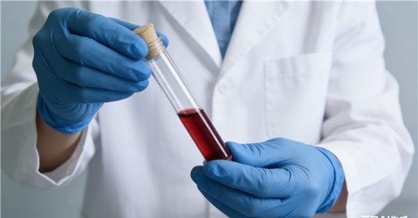 “钻石血”惊现德州！比熊猫血稀有万倍，血液科专家：一生可能仅此一例近日，德州