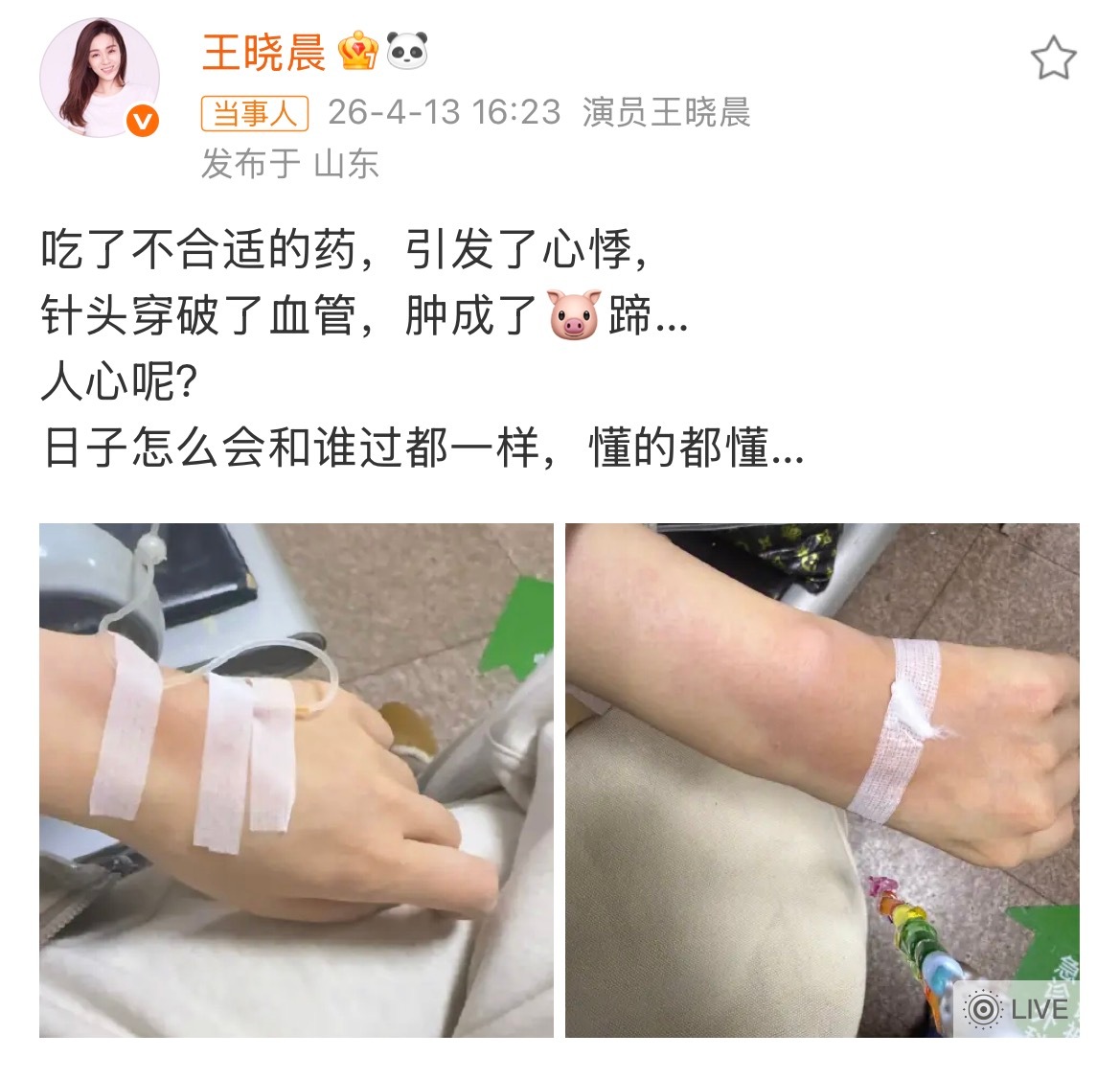 王晓晨吃药引发心悸在身体出现不适症状，输液又肿，身心都会比较崩溃，这时候其实很需