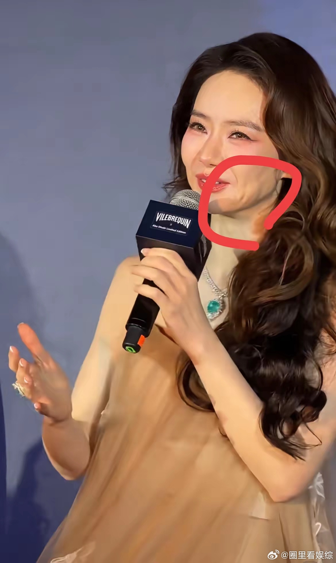戚薇啊，戚薇，好好的就不应该动脸！​感觉她Y美后遗症来了，从正面看还好，脸部线条