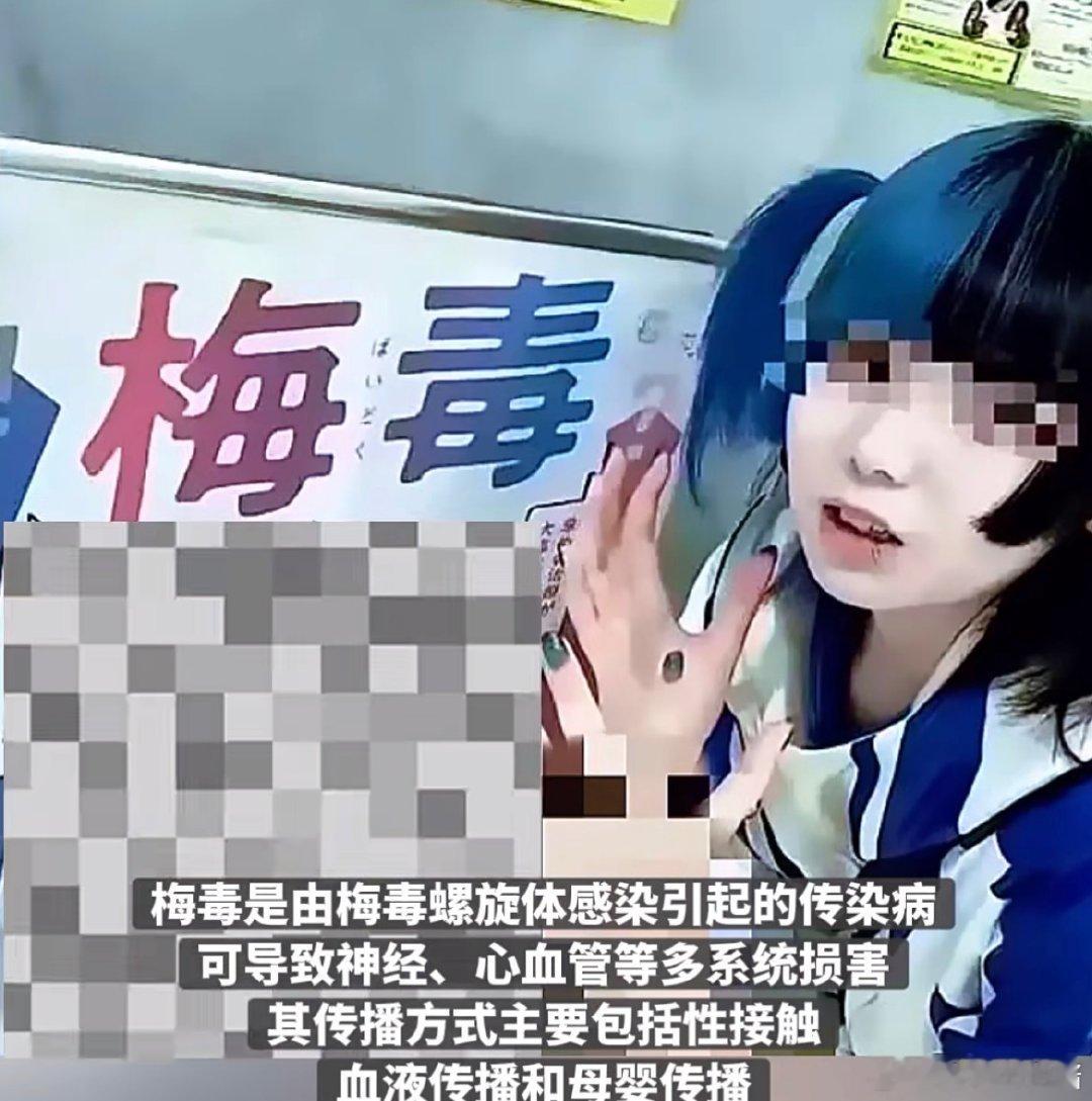 #日本年轻人曾将晒梅毒当潮流##日本梅毒男性20到60岁女性20左右#记得这件事去年就报过了啊，为啥