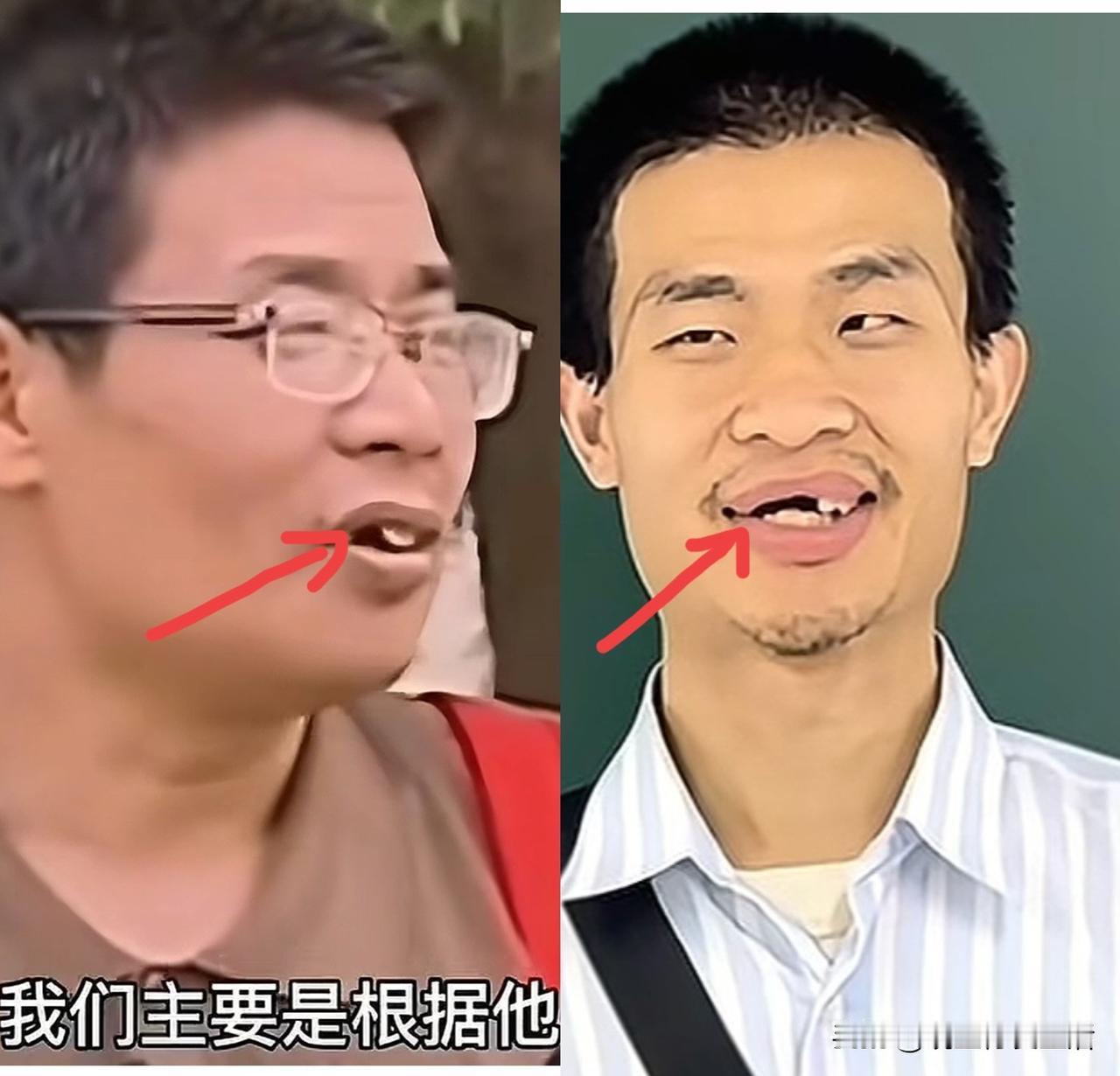 CPU烧干，白愁了？韦东奕的牙齿原来是被父亲带坏的！牵一“牙”而动全网！一时