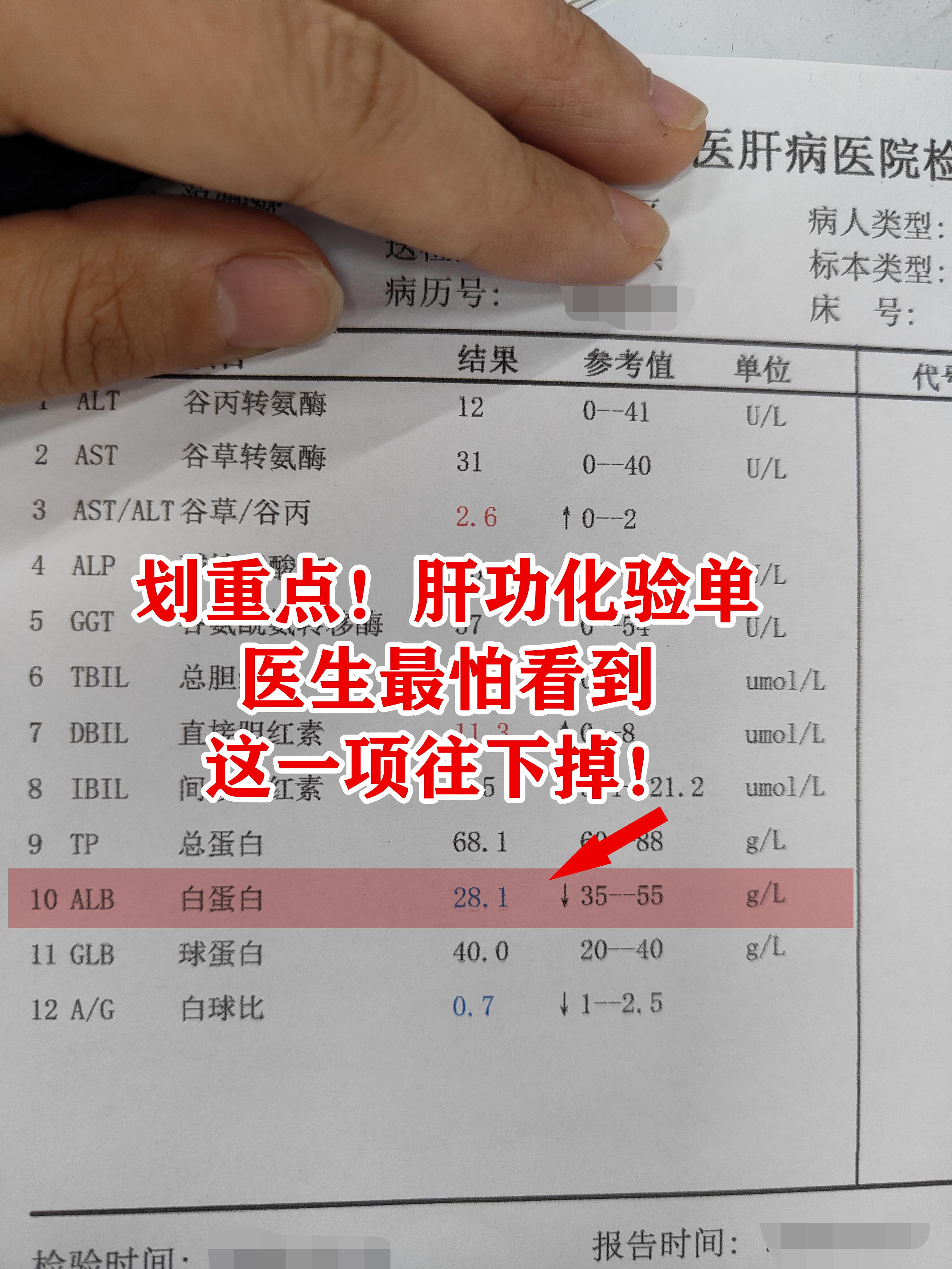看这位朋友的肝功能检查单，看完我心里一沉。大家看，转氨酶ALT、AST...