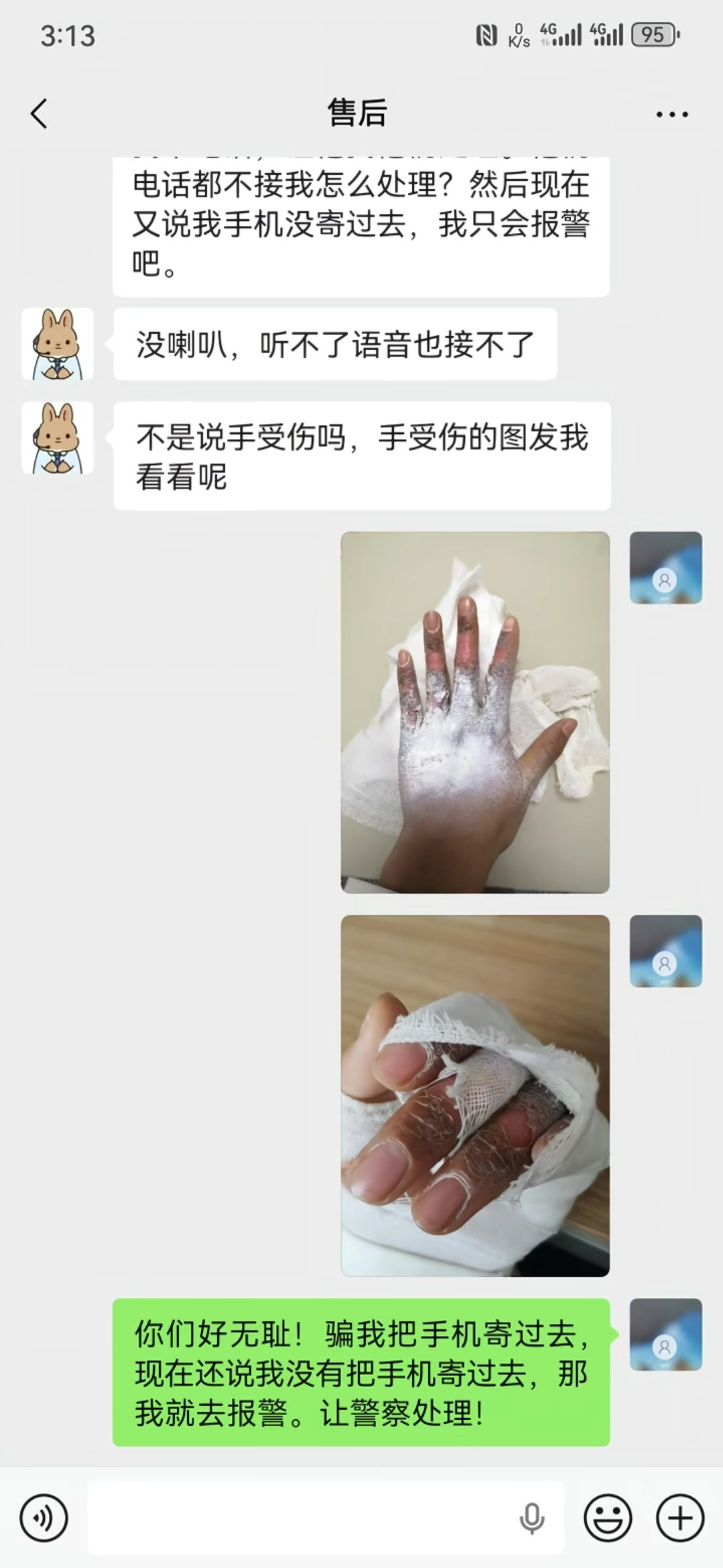 刷到网友用夏新手机，把自己手炸伤的，这是真遇上爆炸机了……杂牌真不能碰！只可惜有