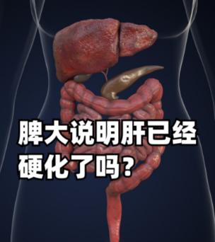 查出脾肿大一定是肝硬化吗？不少人体检时查出脾肿大，第一反应就是慌了神，觉得肯定