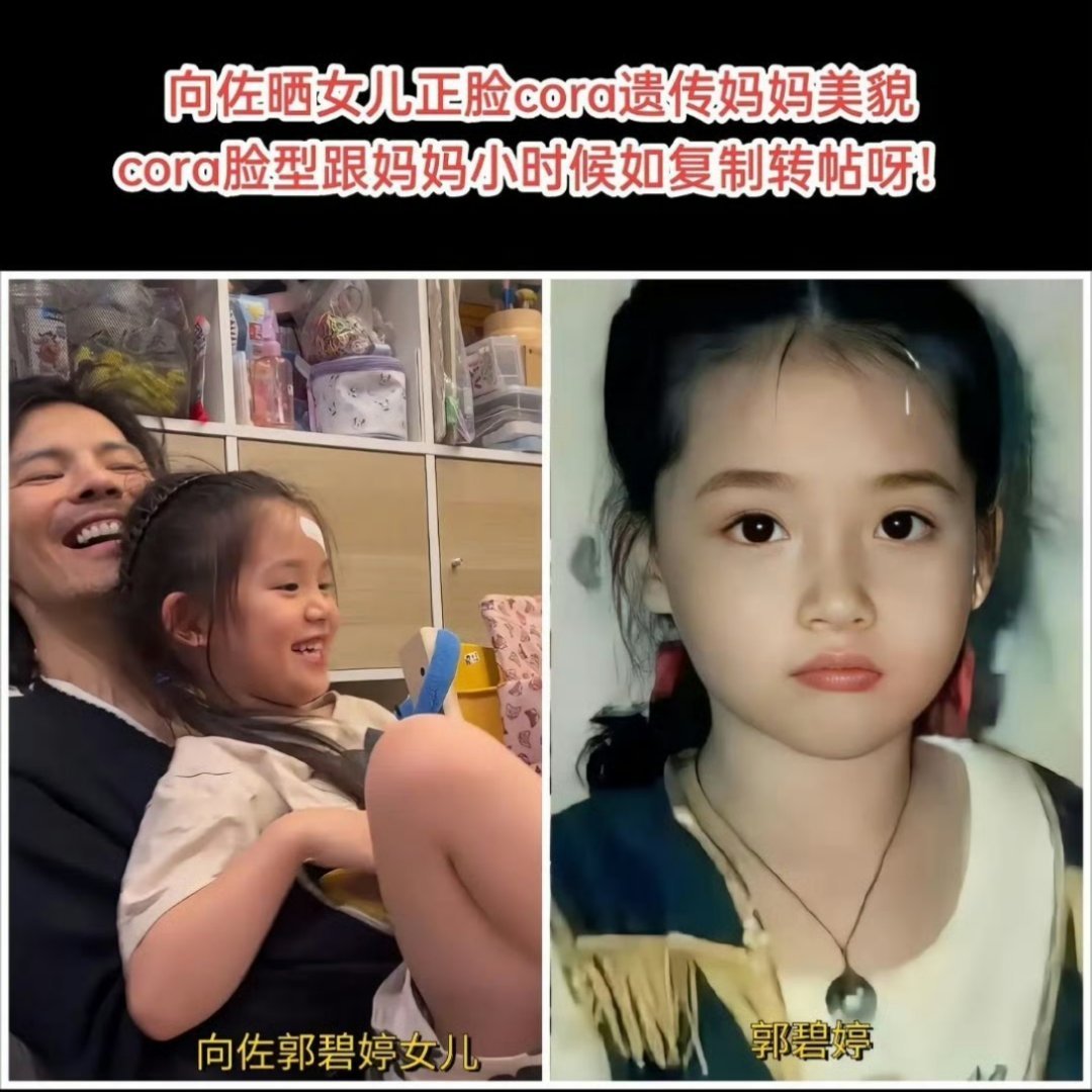 郭碧婷的基因，把向家三代颜值给“格式化”了