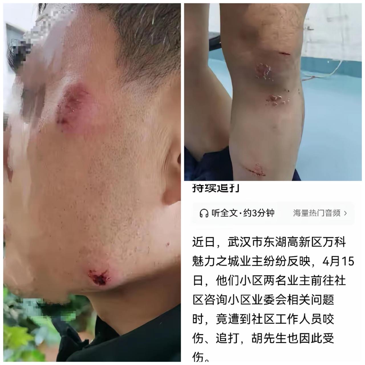 湖北武汉，某小区一男一女两名业主，去社区办公室咨询业委会的事，期间没人搭理他们。